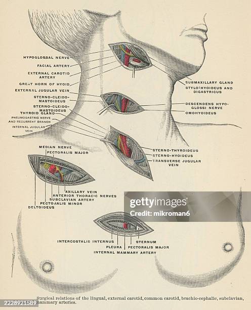 old engraved illustration of surgical relations of the external carotid, lingual, subclavian, brachiocephalic and internal mammary arteries - kleine bloedsomloop stockfoto's en -beelden