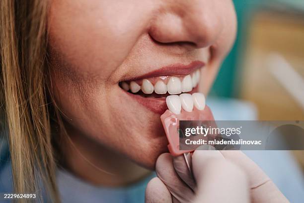 dentista che confronta le tonalità dello sbiancamento dei denti con il sorriso del paziente - sbiancamento dentale foto e immagini stock