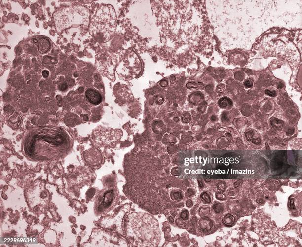 lysosomes in a cell - electron micrograph stock pictures, royalty-free photos & images
