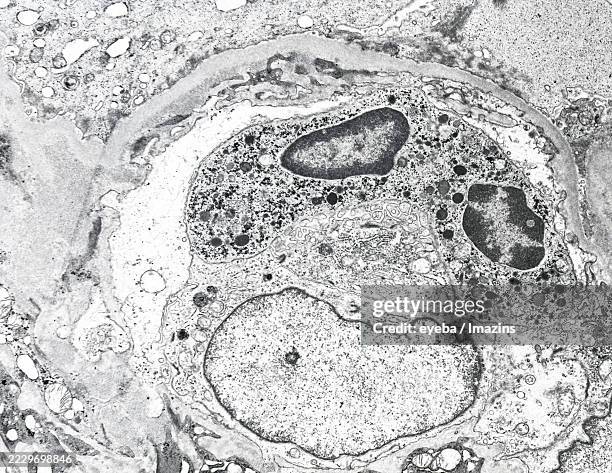 glomerulus, neutrophil, capillary - neutrophil stock pictures, royalty-free photos & images