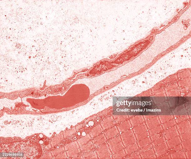 Capillary Rbc Microscope 104 Capillary Laboratory Equipment Stock Photos, High-Res Pictures, and ...