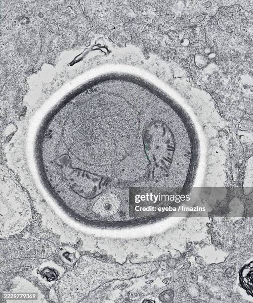 65 Cryptococcus Stock Photos, High-Res Pictures, and Images - Getty Images