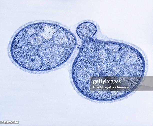 Endocryptococcus 65 Cryptococcus Stock Photos, High-Res Pictures, and Images - Getty Images
