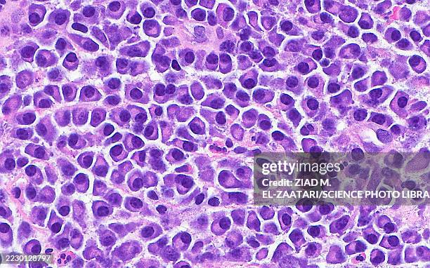 plasma cells, light micrograph - micrografía científica fotografías e imágenes de stock