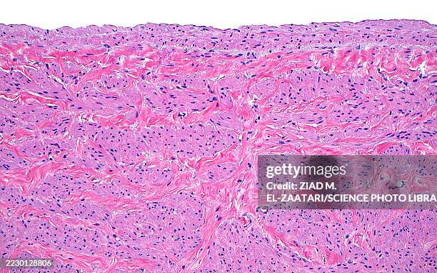 renal vein wall, light micrograph - menschliches gewebe stock-fotos und bilder