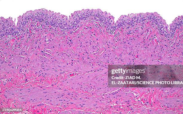 ureter wall, light micrograph - muscle fibre stock pictures, royalty-free photos & images