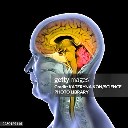 Brain Anatomy Mri Illustration High-Res Vector Graphic - Getty Images