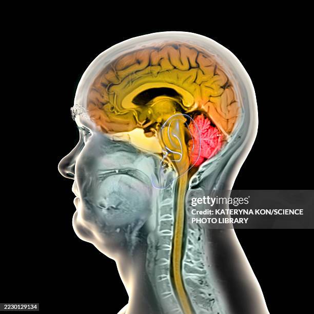 Brain Anatomy Mri Illustration High-Res Vector Graphic - Getty Images