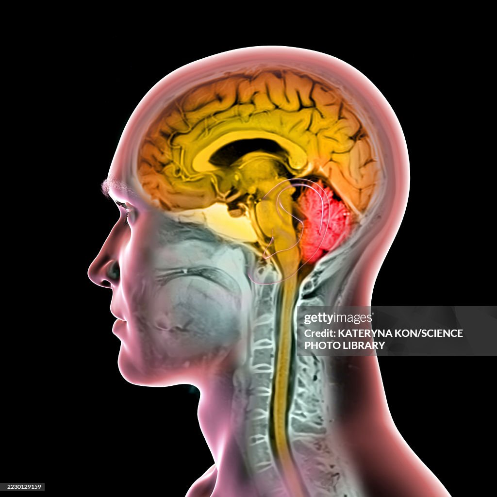 Brain Anatomy Mri Illustration High-Res Vector Graphic - Getty Images