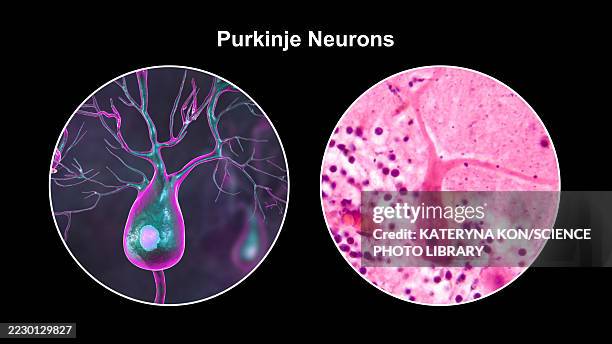purkinje neurons and light micrograph, illustration - light micrograph stock illustrations