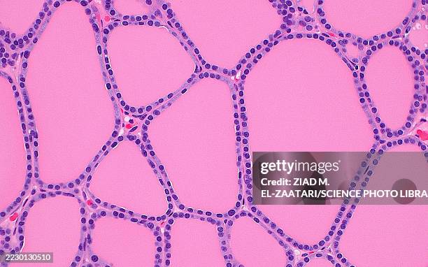 thyroid follicles, light micrograph - endocrine system stock pictures, royalty-free photos & images