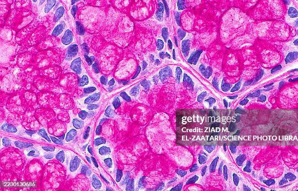 colon crypt cross-sections, light micrograph - goblet cell stock pictures, royalty-free photos & images