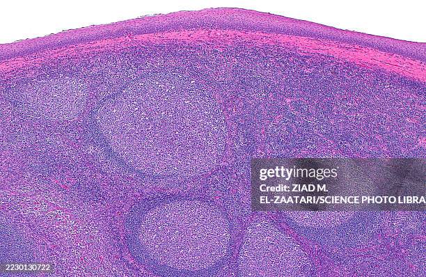 tonsil, light micrograph - squamous epithelium stock pictures, royalty-free photos & images