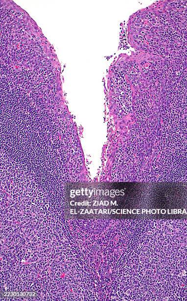 tonsil crypt, light micrograph - squamous epithelium stock pictures, royalty-free photos & images