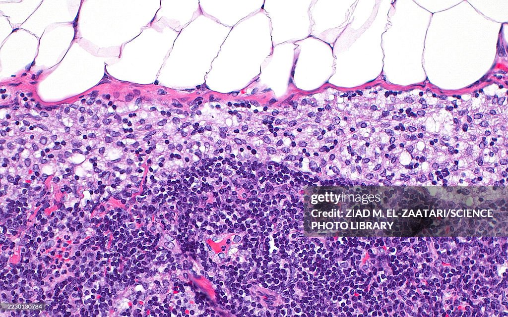 Lymph node subcapsular sinus, light micrograph