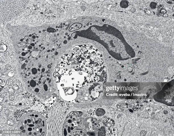 electron micrograph of a neutrophil engulfing a dead cell in liver tissue - neutrophil stock pictures, royalty-free photos & images