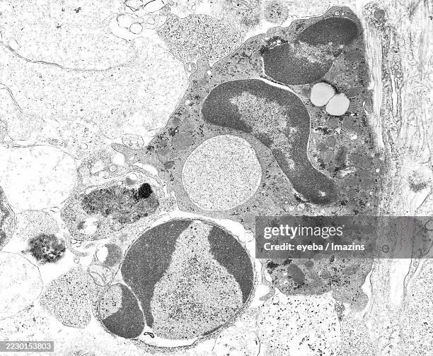 transmission electron micrograph of a single apoptotic cell being approached by a neutrophil - neutrophil stock pictures, royalty-free photos & images