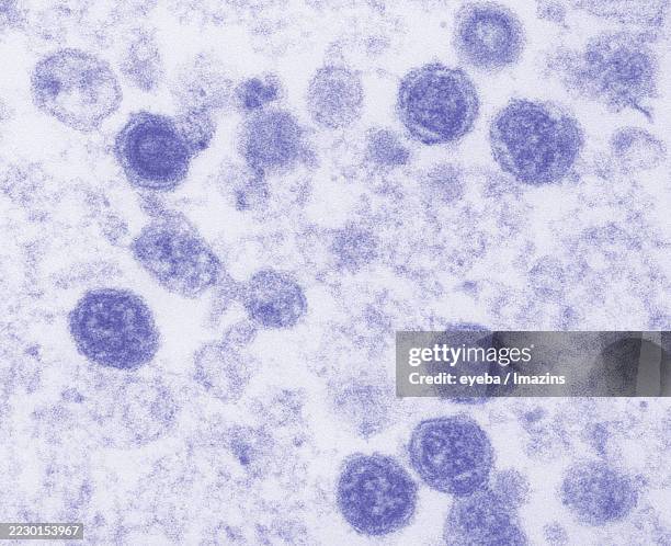 retroviruses as seen by transmission electron microscopy - magnification stock pictures, royalty-free photos & images