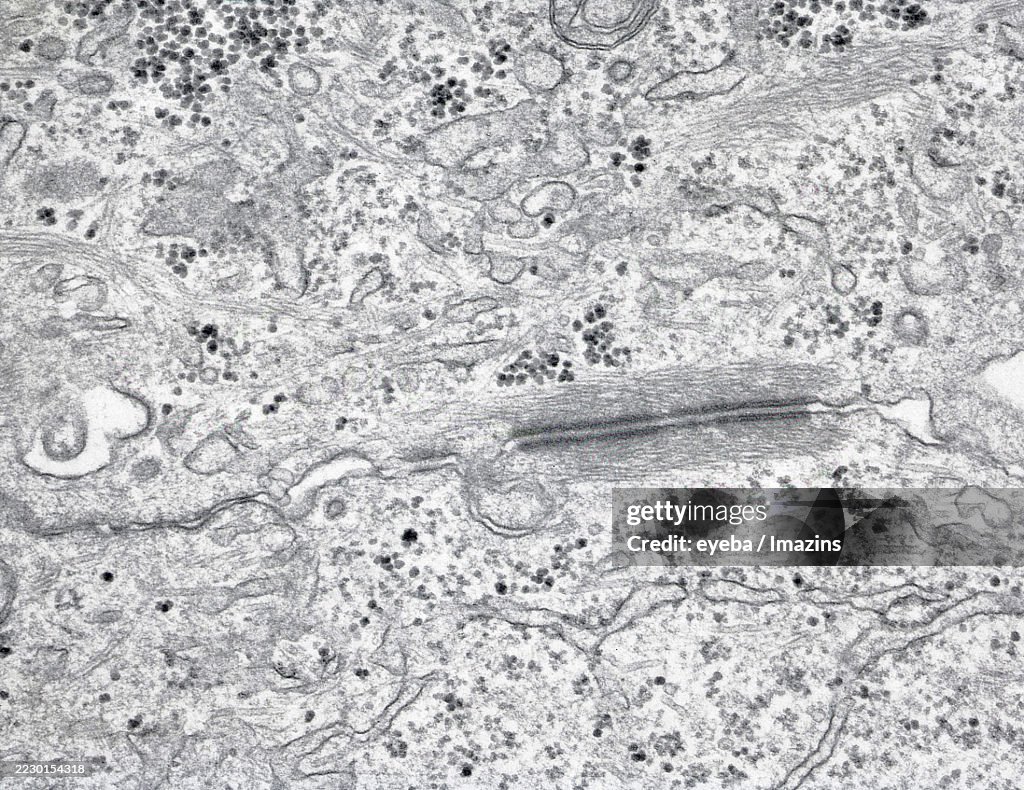 Electron micrograph of desmosomes at the epithelial cell border, 30,000x