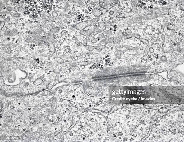 electron micrograph of desmosomes at the epithelial cell border, 30,000x - desmosome stock pictures, royalty-free photos & images