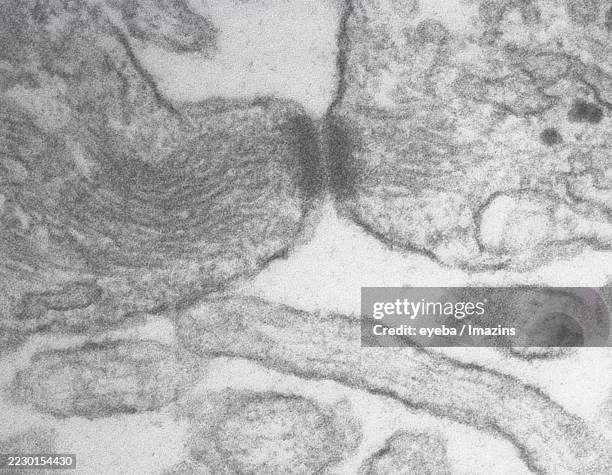 electron micrograph of the boundary between two cultured epithelial cells forming desmosomes - desmosome stock pictures, royalty-free photos & images