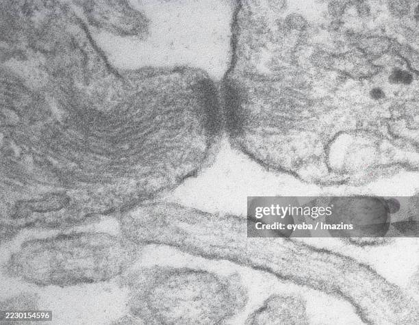 high-magnification 100,000x electron micrograph of the boundary between two cultured epithelial cells forming desmosome - desmosome stock pictures, royalty-free photos & images
