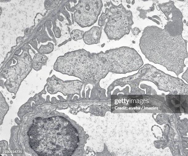electron micrograph of a glomerulus of the kidney - electron micrograph stock pictures, royalty-free photos & images