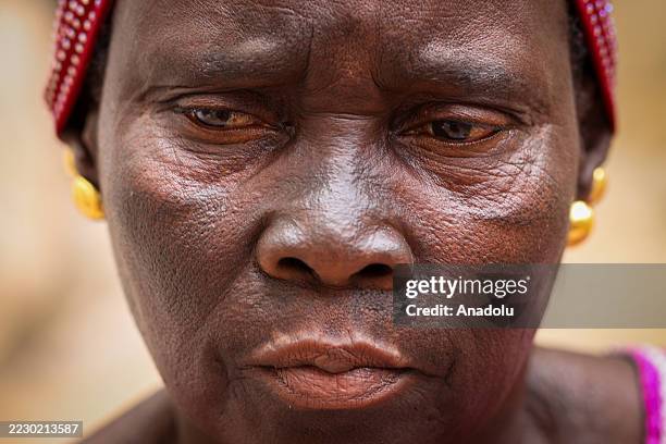 Year-old Astou Ndiaye, who used skin-lightening products for a period in her youth speaks to AA in Dakar, Senegal on August 11, 2025. Skin bleaching...