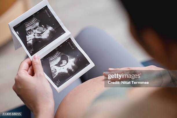 in new motherhood, fetal health monitoring through regular ultrasounds and check-ups enables constant monitoring of the fetus's growth and development. - ultraljud bildbanksfoton och bilder