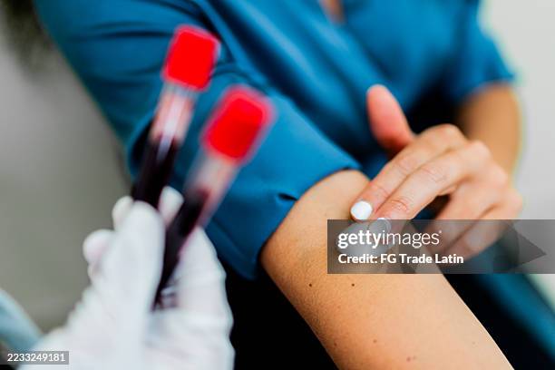 primo piano della donna paziente dopo l'esame del sangue - provetta per campioni ematici foto e immagini stock