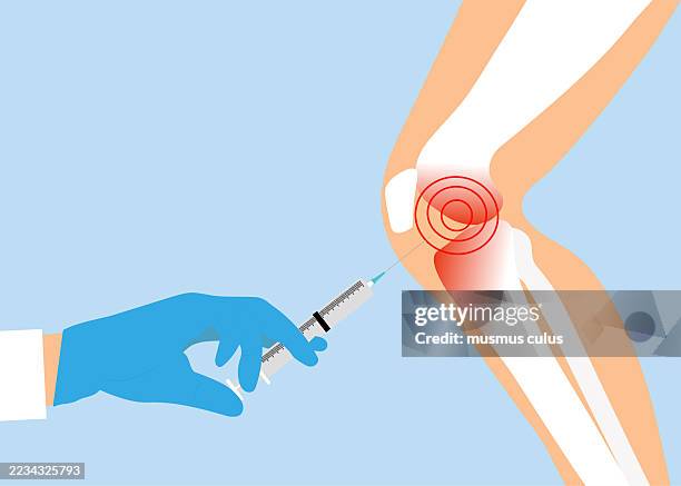 ilustraciones, imágenes clip art, dibujos animados e iconos de stock de ilustración de la inyección de rodilla para aliviar el dolor articular - plasma rico en plaquetas