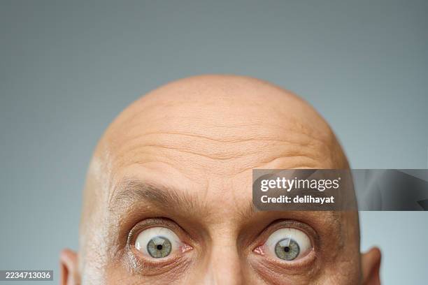 a bald man stares into the camera, his wide eyes betraying his surprise, with only the upper portion of his head in the frame - twijfel stockfoto's en -beelden