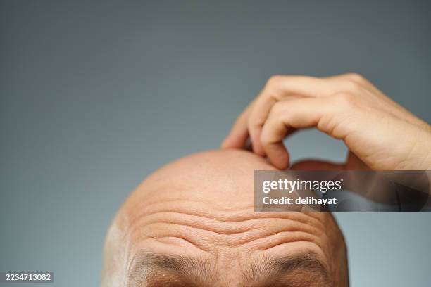 un homme aux sourcils arqués et au front plissé se gratte le crâne chauve, seule la partie supérieure de son cuir chevelu étant visible - complètement chauve photos et images de collection