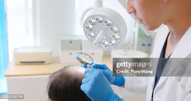 clinic doctor examining scalp - hairline polished metal stock pictures, royalty-free photos & images