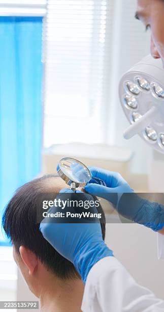 clinic doctor examining scalp - hairline polished metal stock pictures, royalty-free photos & images