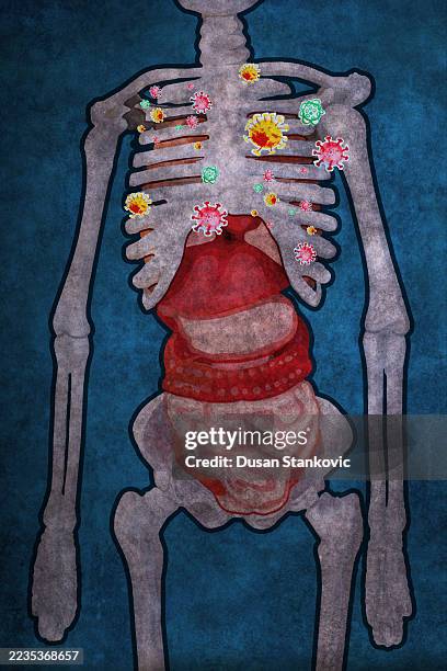 ilustrações de stock, clip art, desenhos animados e ícones de viral infection in the body - organismo acidófilo