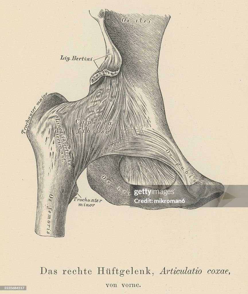 Old engraved illustration of the hip joint, a ball and socket synovial type joint between the head of the femur and acetabulum of the pelvis