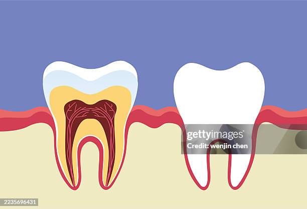 dental health comparison - periodontal disease stock illustrations