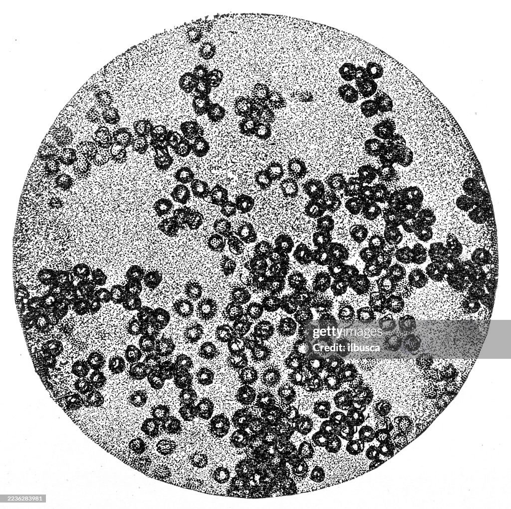 Bacterial Biology Microscope Image, Spheroidal Bacteria, Micrococci