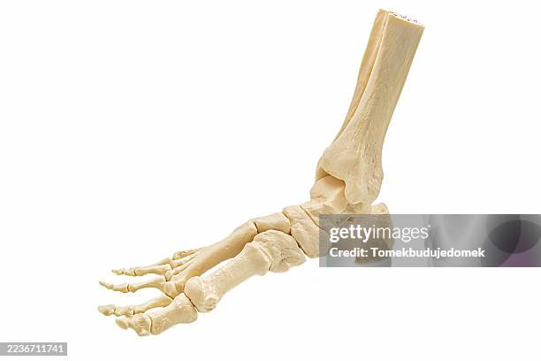 foot - plantar fasciitis stock pictures, royalty-free photos & images
