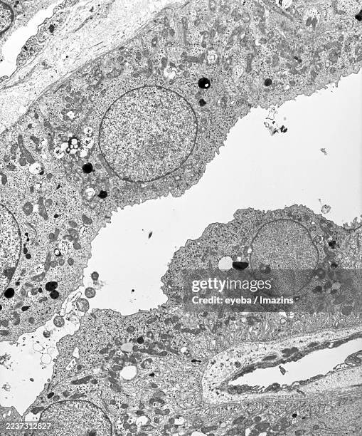 electron micrograph of a renal tubule, 3,000x - tubule stock pictures, royalty-free photos & images