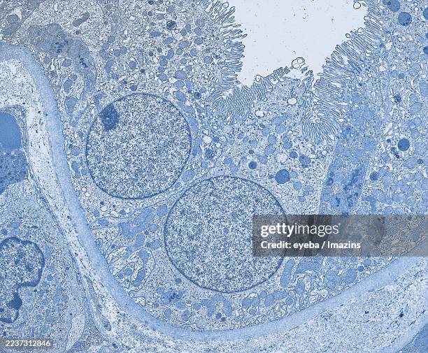 electron micrograph of a renal tubule, 3,000x - tubule stock pictures, royalty-free photos & images