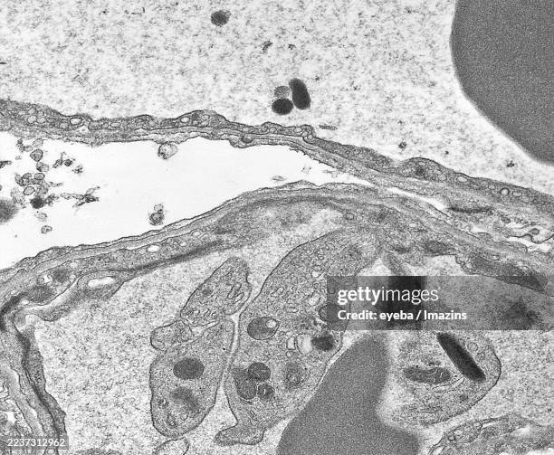 electron micrograph of alveolar basement membrane and platelets, 15,000x - basement membrane stock pictures, royalty-free photos & images