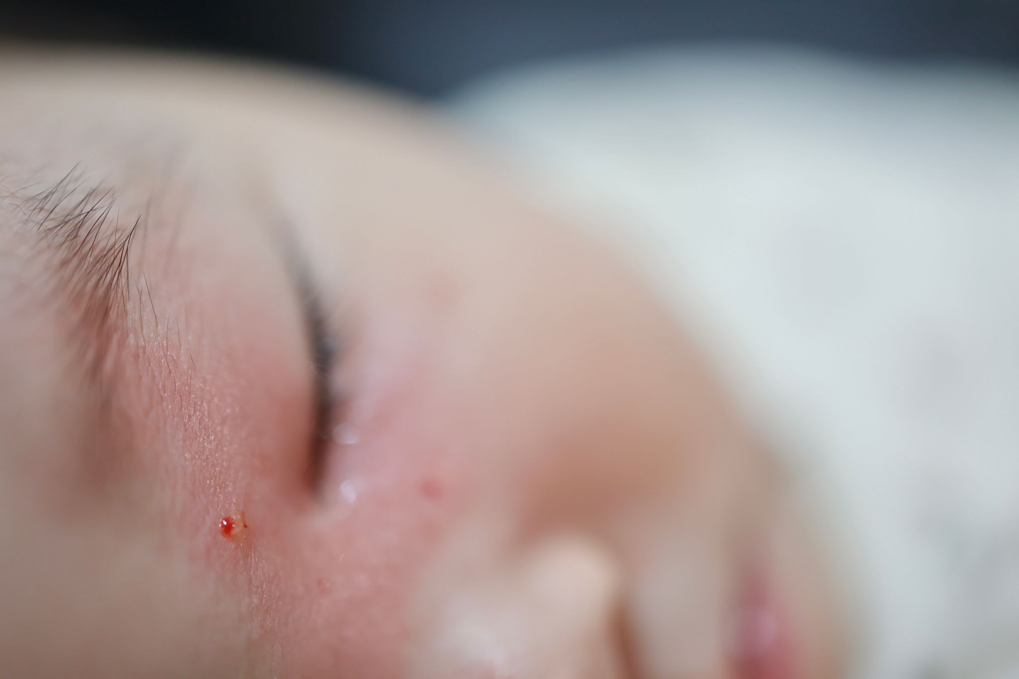 skincare consultation