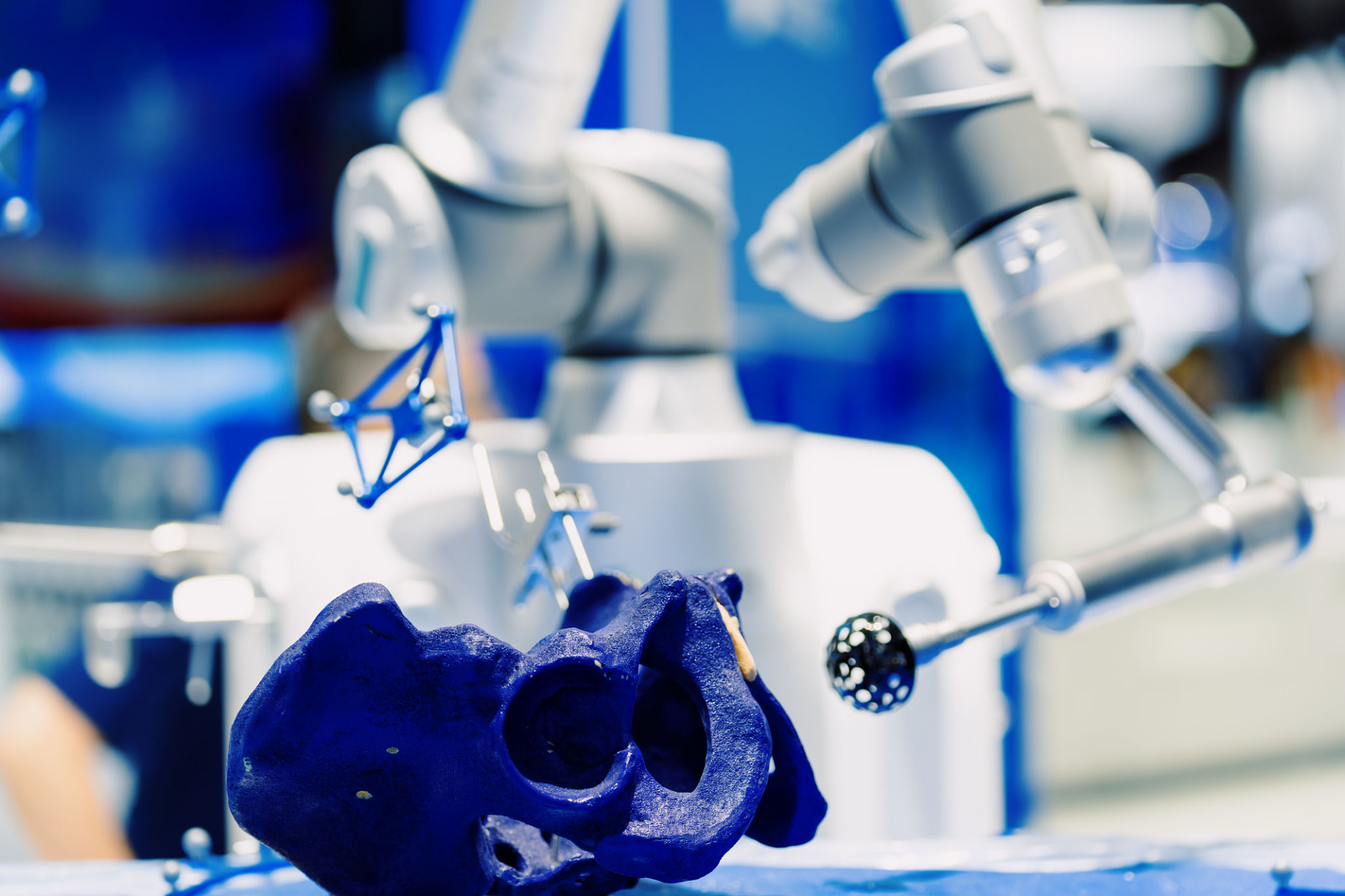 robotic surgery