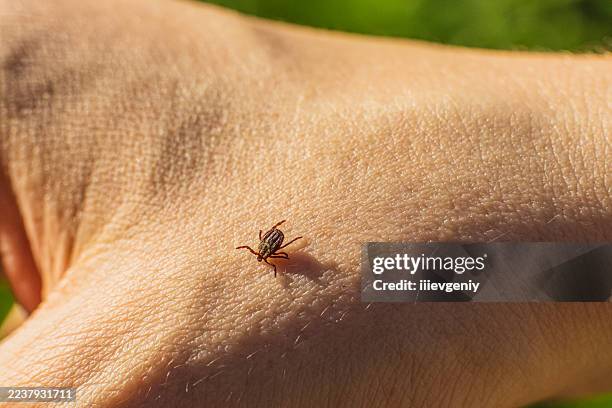 tick on the skin - tique à pattes noires photos et images de collection