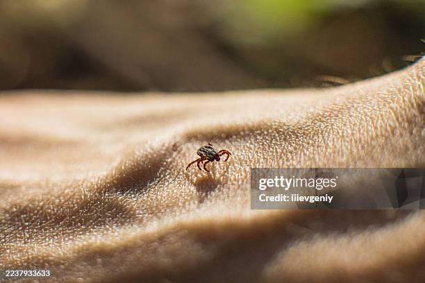tick on the skin - tique à pattes noires photos et images de collection