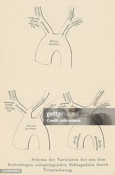 old engraved illustration of the aortic arch, the curved segment of the aorta that connects the ascending aorta to the descending aorta - kleine bloedsomloop stockfoto's en -beelden