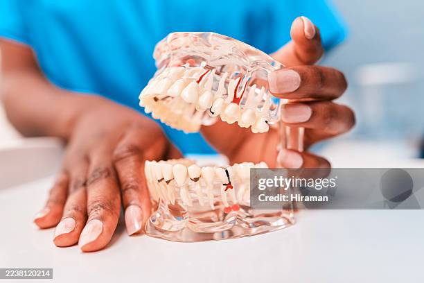 dental model demonstration in modern dentistry practice with two dentists assessing teeth - dentin stock pictures, royalty-free photos & images