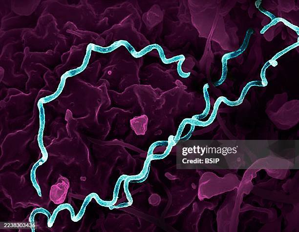 Colorized electron micrograph of Treponema pallidum, the bacteria that cause syphilis. Several spiral-shaped bacteria have been highlighted in teal.